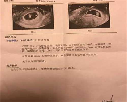 广州供卵医院在哪里_供卵移植冻胚前后用药_受精卵对植入有反应吗？