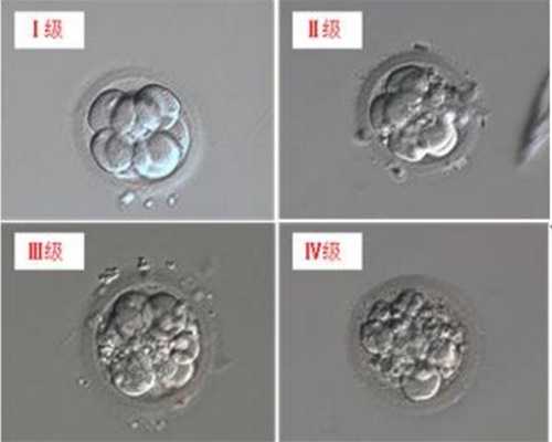 私人供卵自孕试管婴儿机构_广州供卵试管做几代_慢性盆腔炎的常见病因有哪些