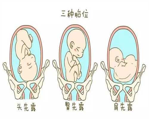 广州金贝供卵医院官网_闭经能做试管供卵吗_研究发现 试管婴儿的出生缺：怎么