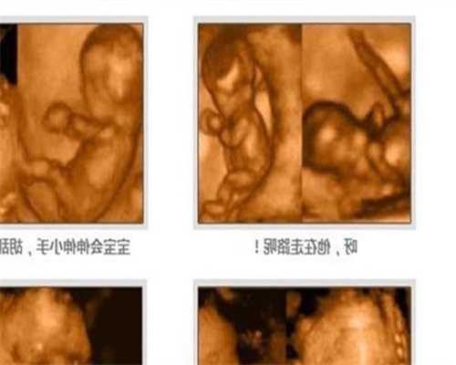 广州卵巢早衰供卵不排队_供卵成功率有多高_试管婴儿准妈妈须知