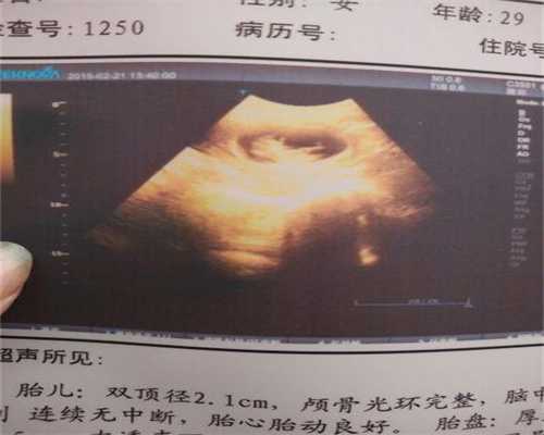 做了供卵会后悔吗_广州供卵自怀是什么意思_引诱五个多月的胎儿会哭吗？